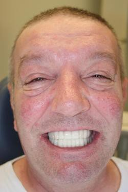actual patient after 1
