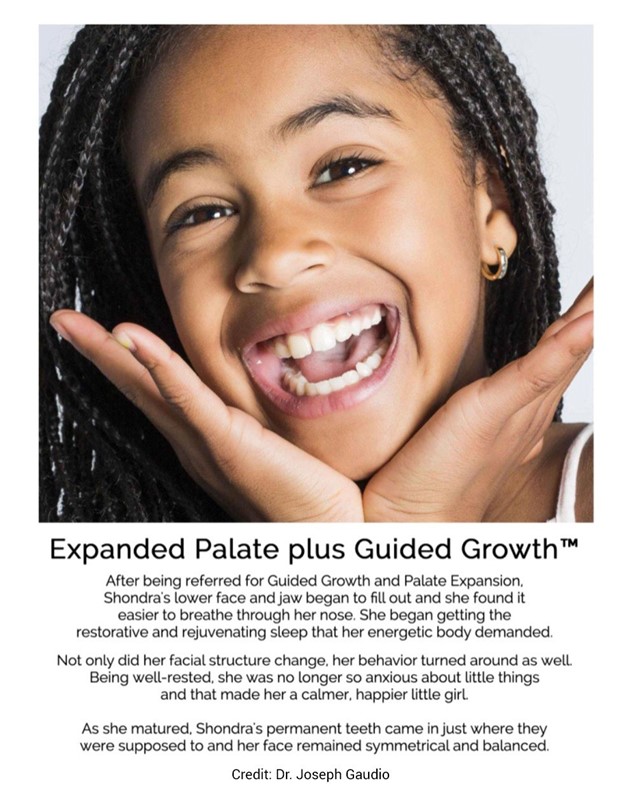 Expanded Palate plus Guided Growth