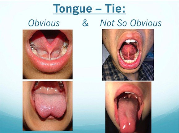 Get Tongue Tied