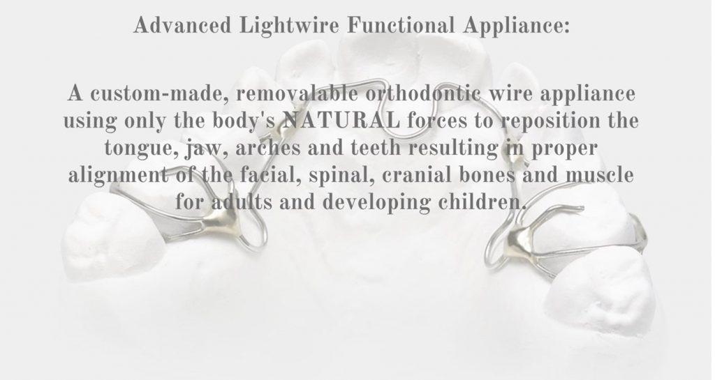 Advanced Lightwire Functional Appliance