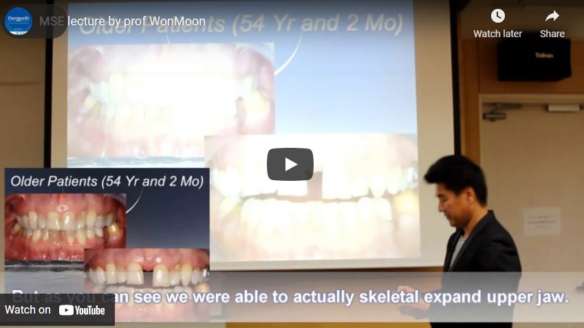 Watch MSE lecture by prof WonMoon
