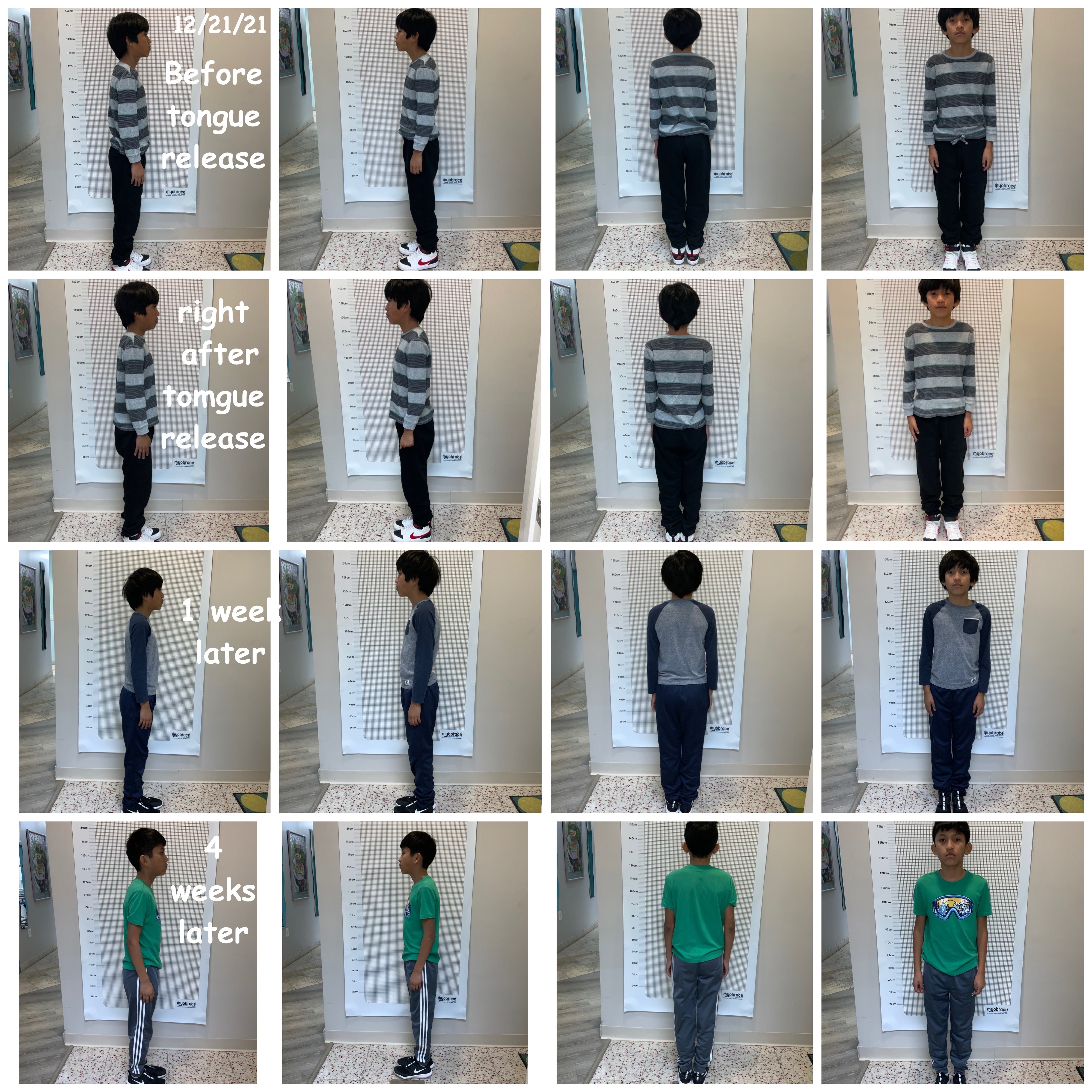 a series of photos of a young boy's posture improvement from straight on