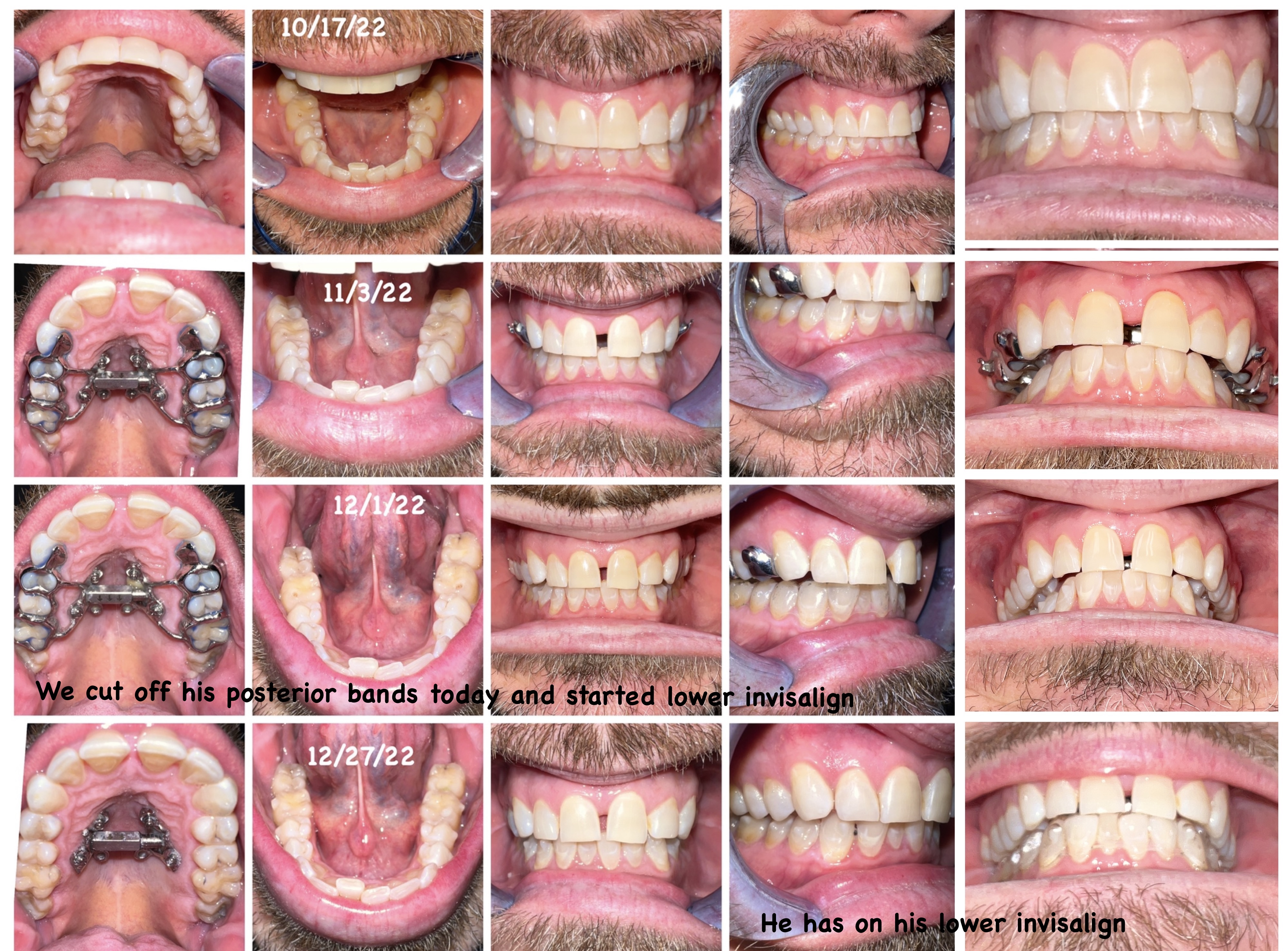 additional male patient result photos