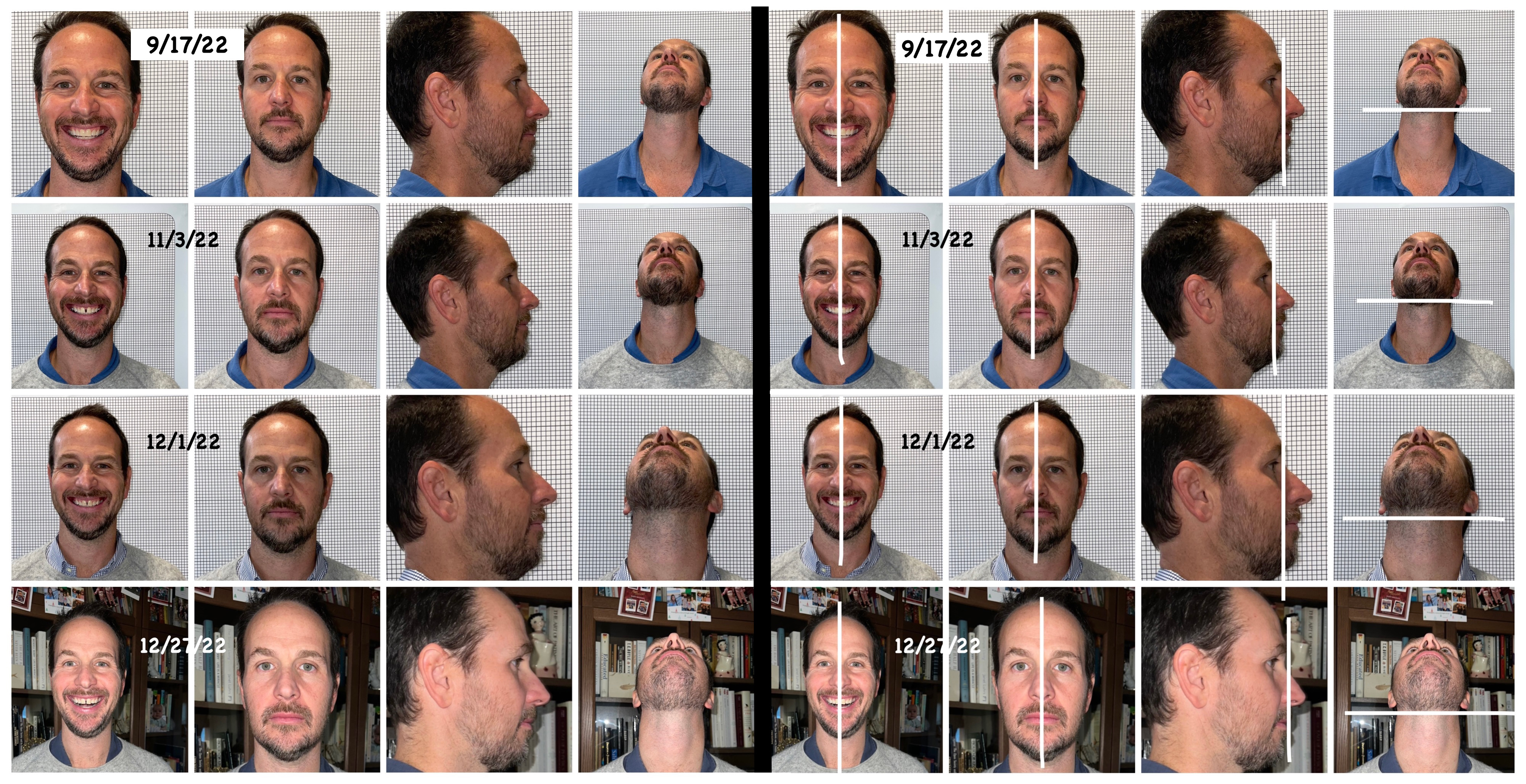 male patient result photos