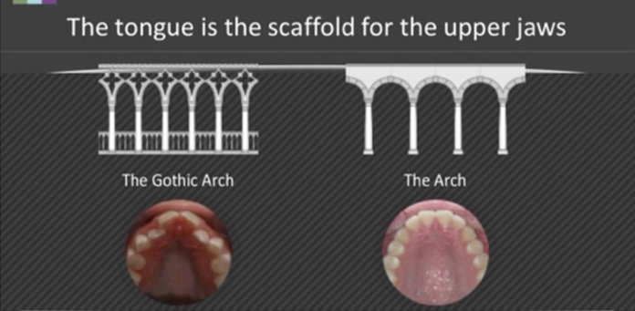 the tongue is the scaffold for the upper jaws