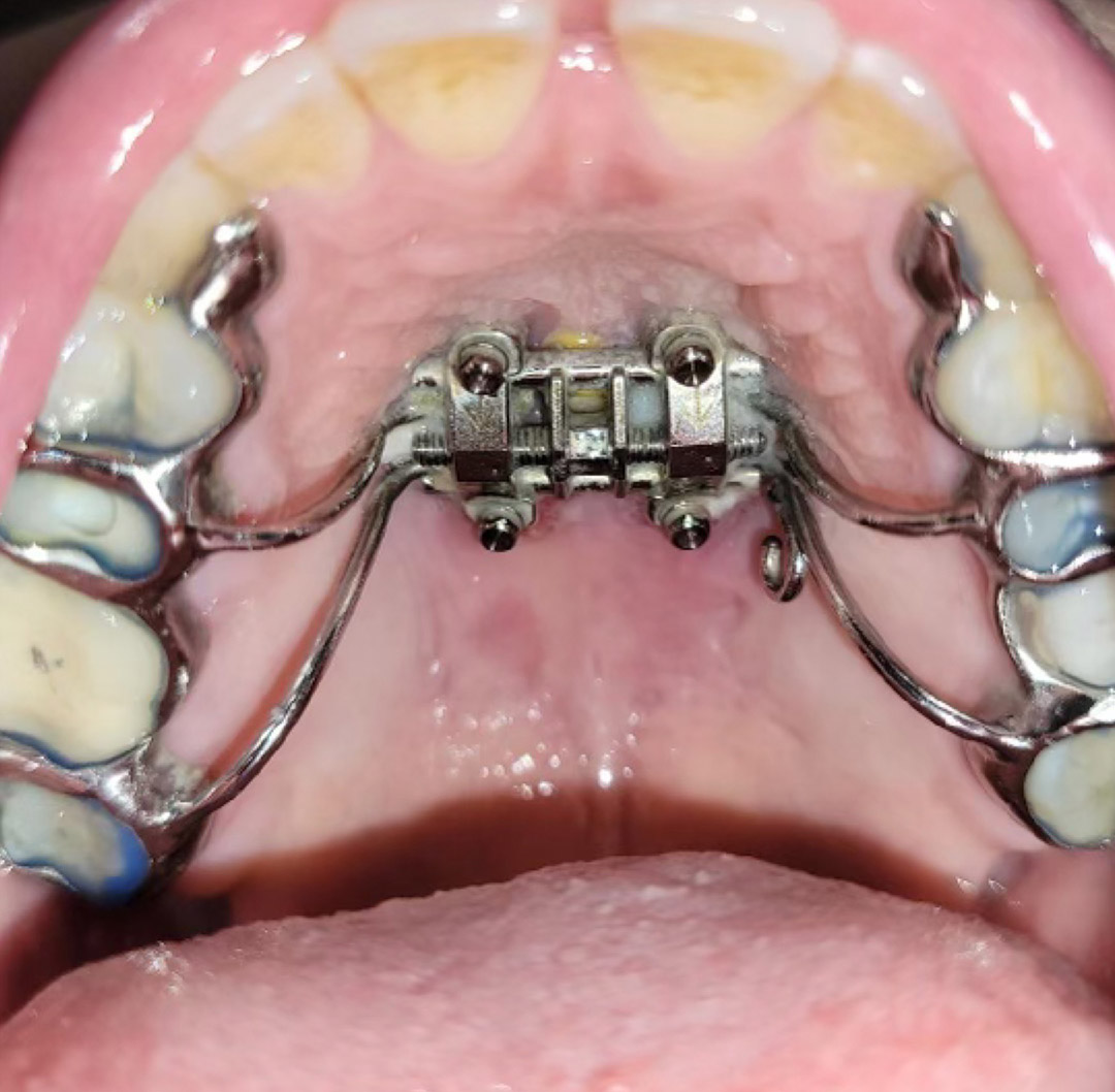 results of one month of progress