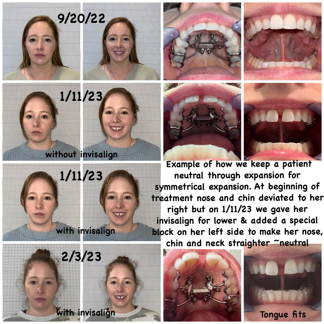 series of progress photos